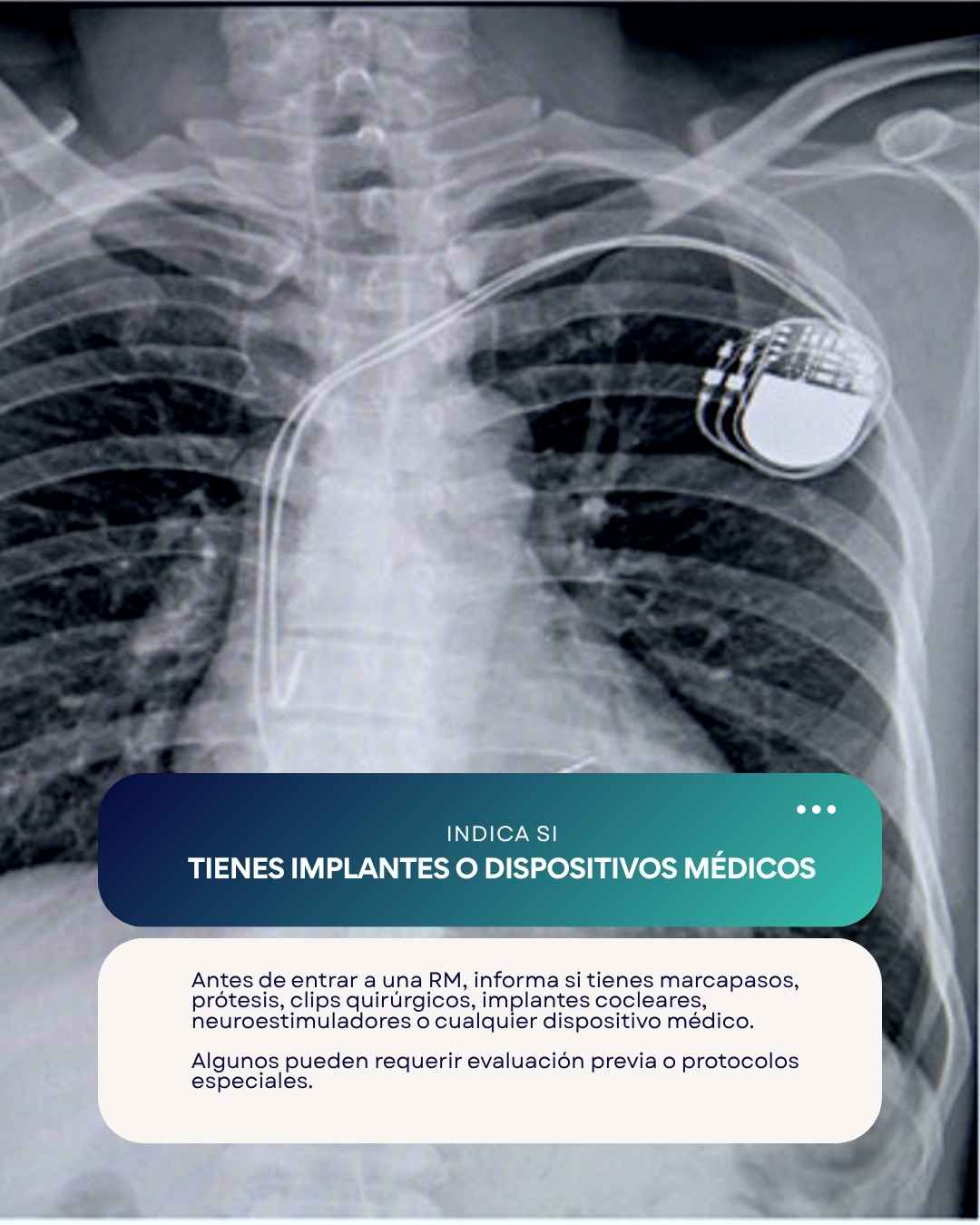 Instagram post created for Pro Imágenes