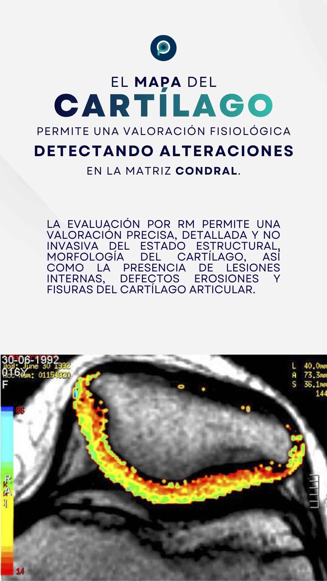 Instagram story created for Pro Imágenes