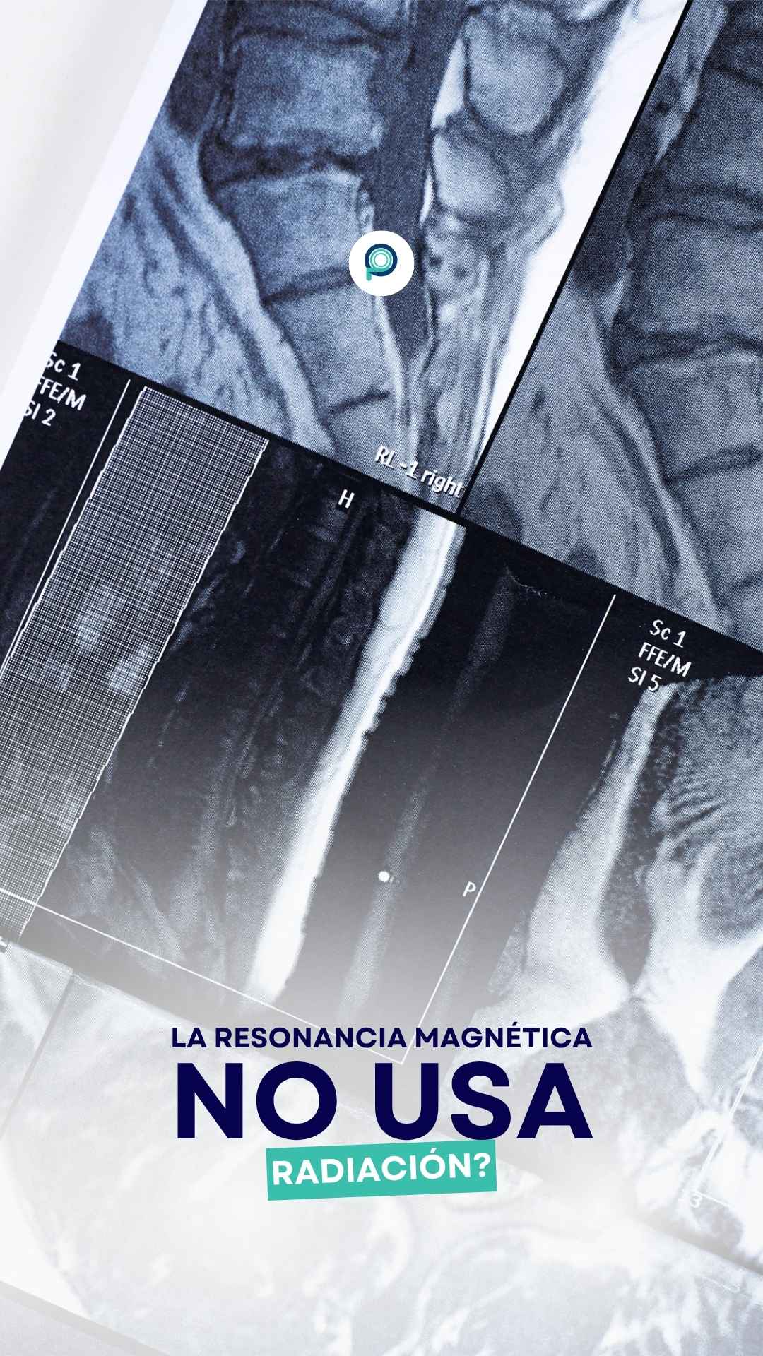 Instagram story created for Pro Imágenes