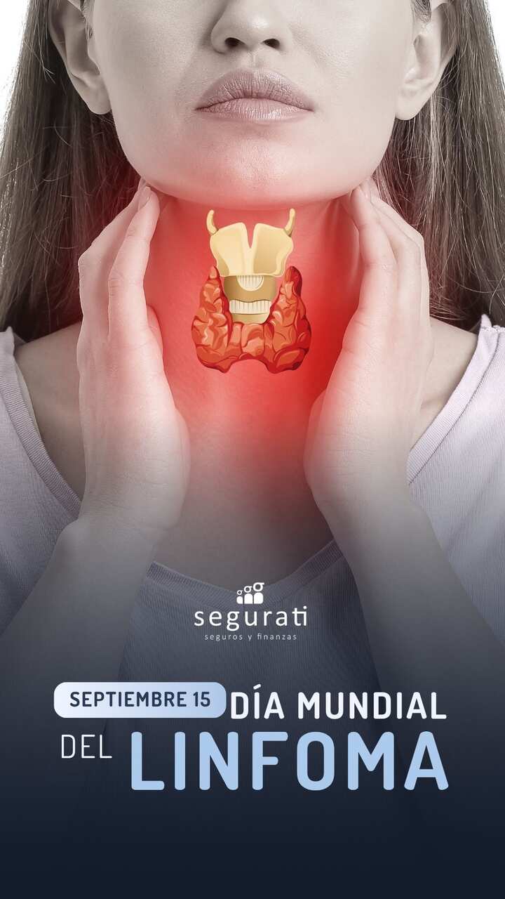 Story for Segurati